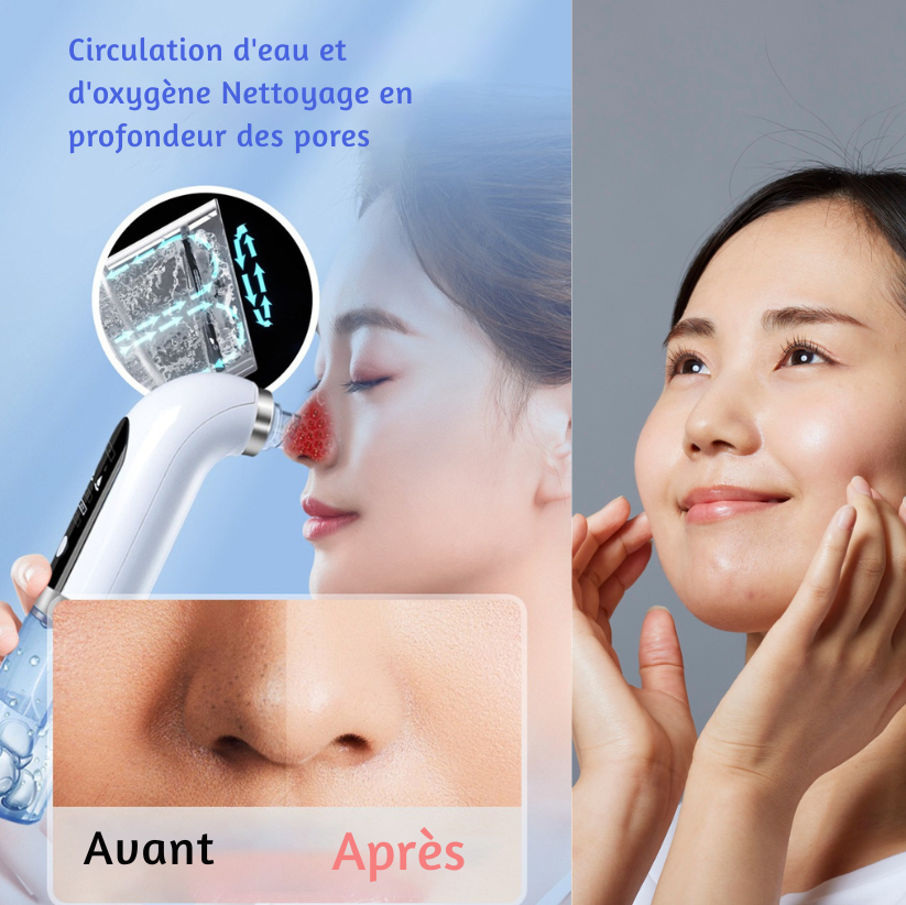 🌸 Aspirateur à Points Noirs Professionnel – Multi-fonction & Sécurisé
