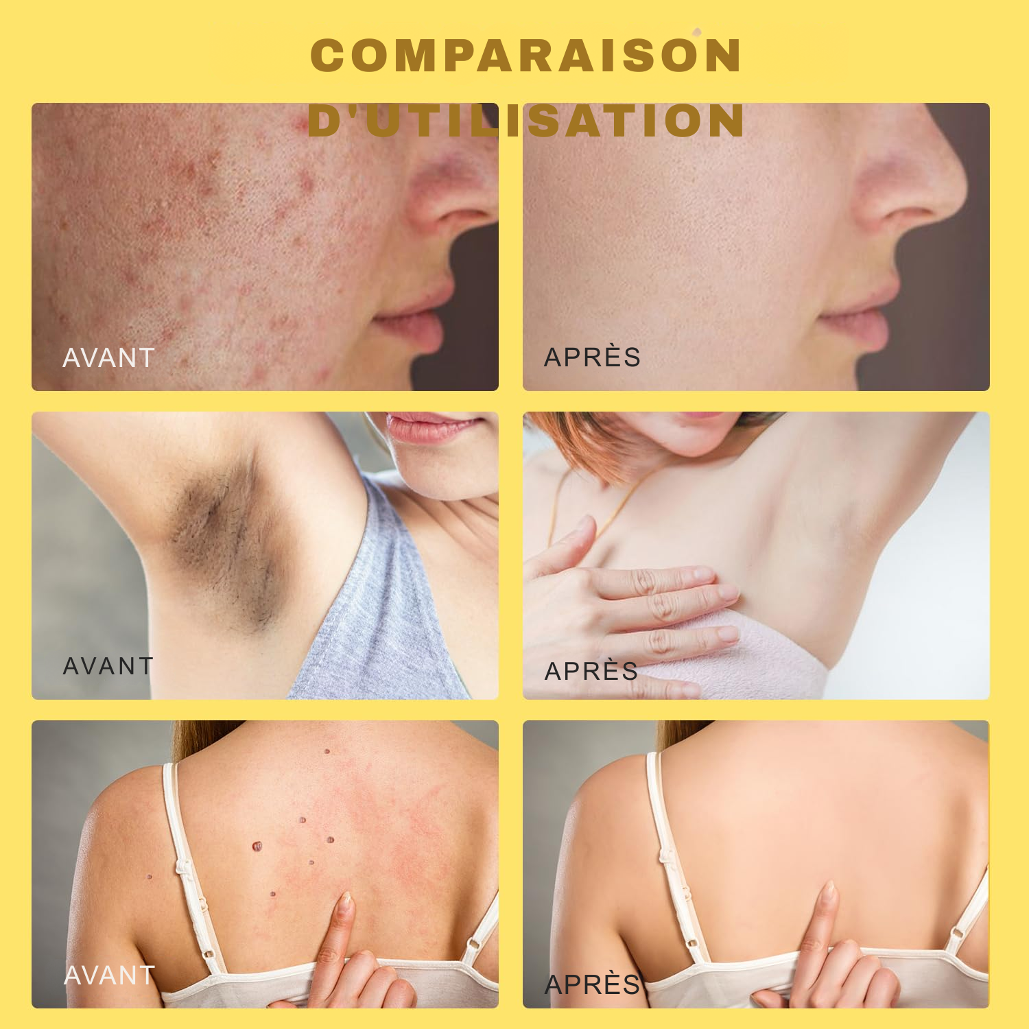 Lot de 2 Crèmes au Venin d’Abeille – Crème Réparatrice Naturelle – Hydratant Professionnel pour Tous Types de Peau