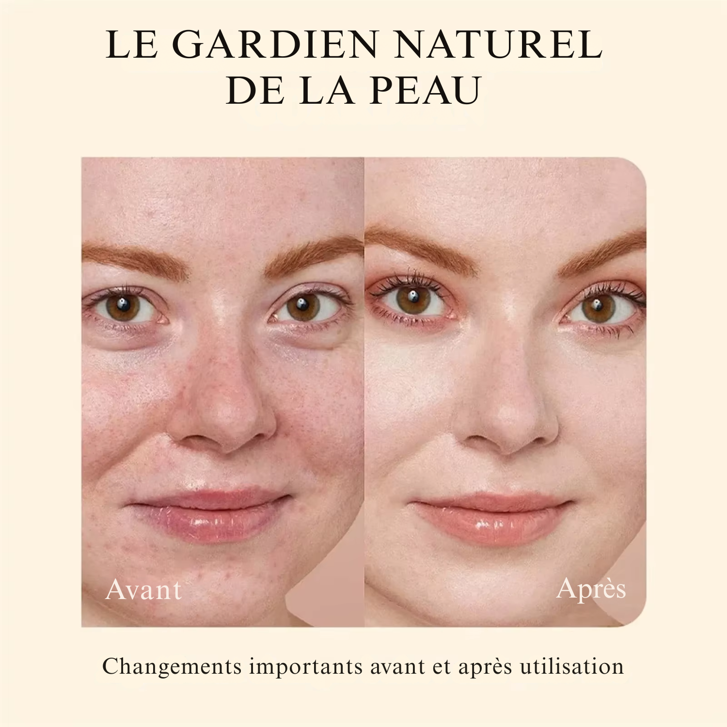 Crème Hydratante Visage au Suif de Bœuf & Miel – 100 g Baume Fouetté Naturel pour le Visage & le Corps – Suif de Bœuf Nourri à l’Herbe