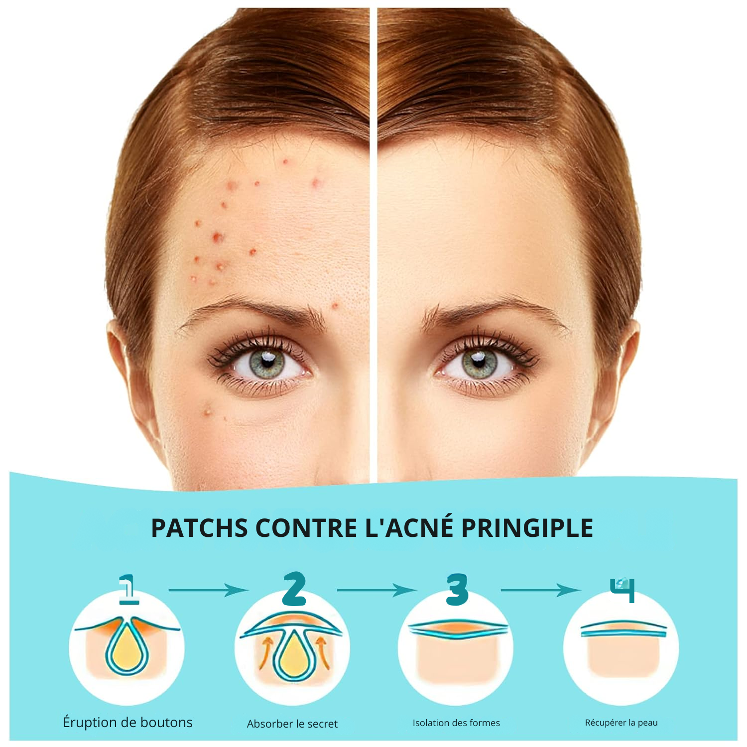 180 Patchs Anti-Boutons pour le Visage – Patchs d’Acné Invisibles en Hydrocolloïde